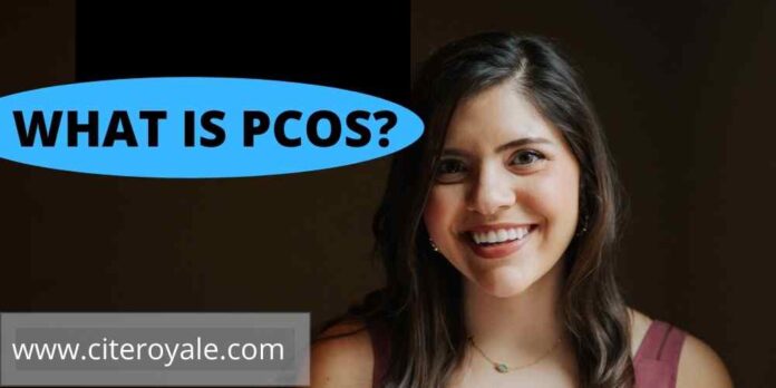 Pcos(Polycystic ovarian syndrome)